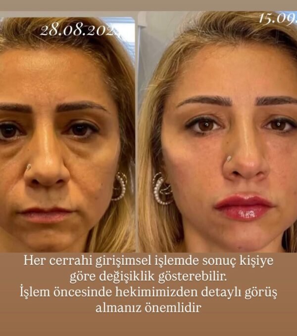 WhatsApp Image 2025-12-15 at 11.38.26 (3)