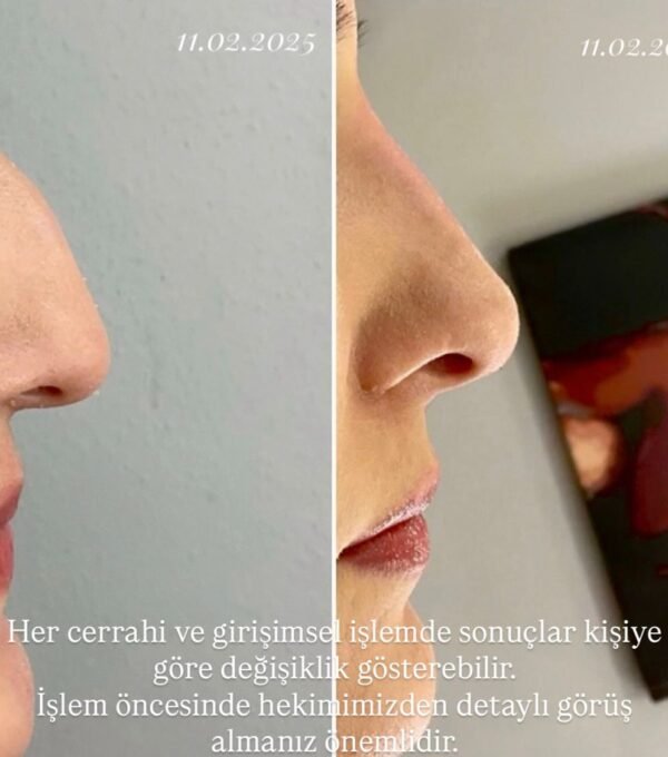 WhatsApp Image 2025-12-15 at 11.38.26