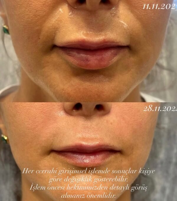 WhatsApp Image 2025-12-15 at 12.18.04